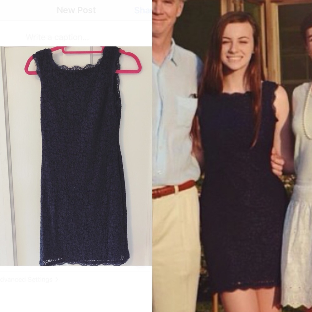 Blue lace mini dress